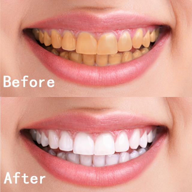 Bột Tẩy Trắng Răng Than Tre Hoạt Tính