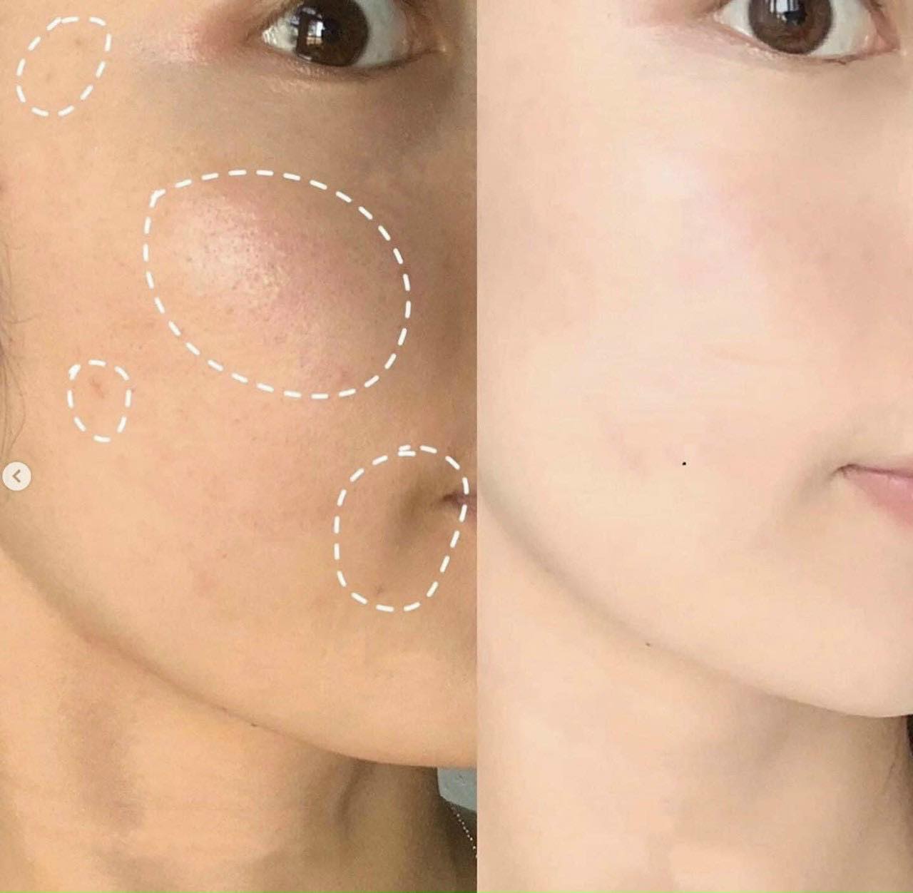 DSP pigment zero bright tinh chất làm sáng da