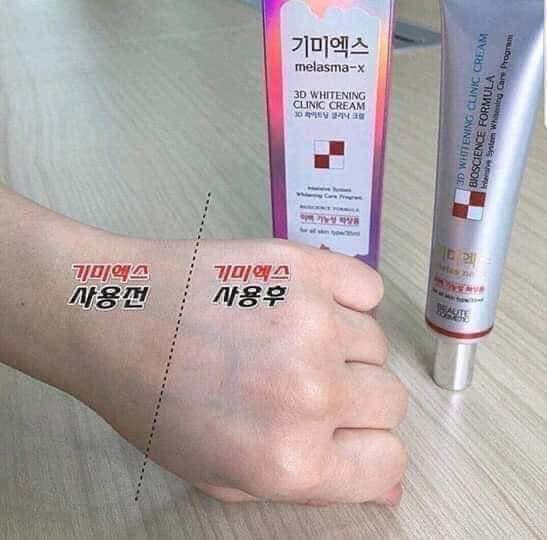 Kem tr.ị nám 3D Melasma - 3W Clinic hàn quốc