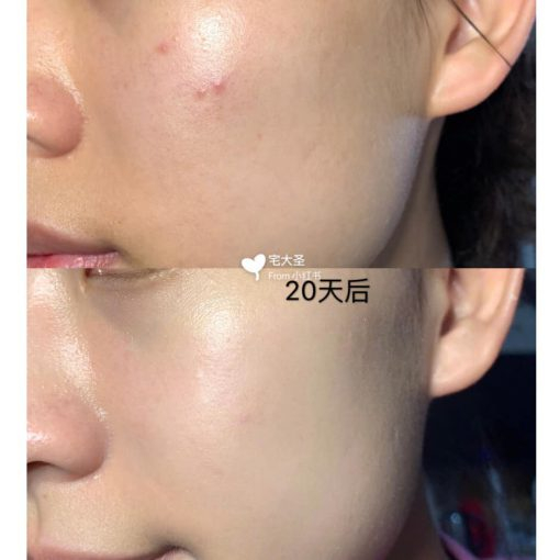 Kem Dưỡng Some By Mi AHA-BHA-PHA Miracle Cream 30 Days 50ml