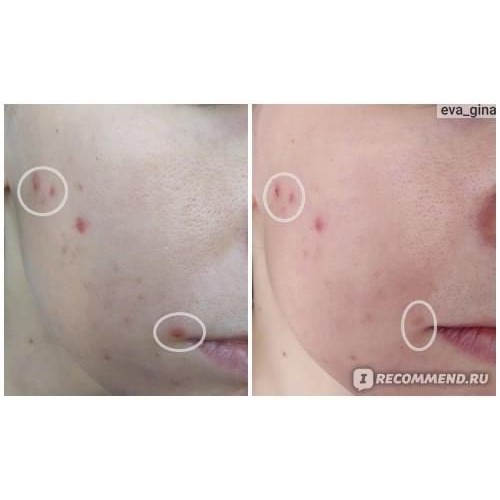 Mặt nạ Compliment Green Mask