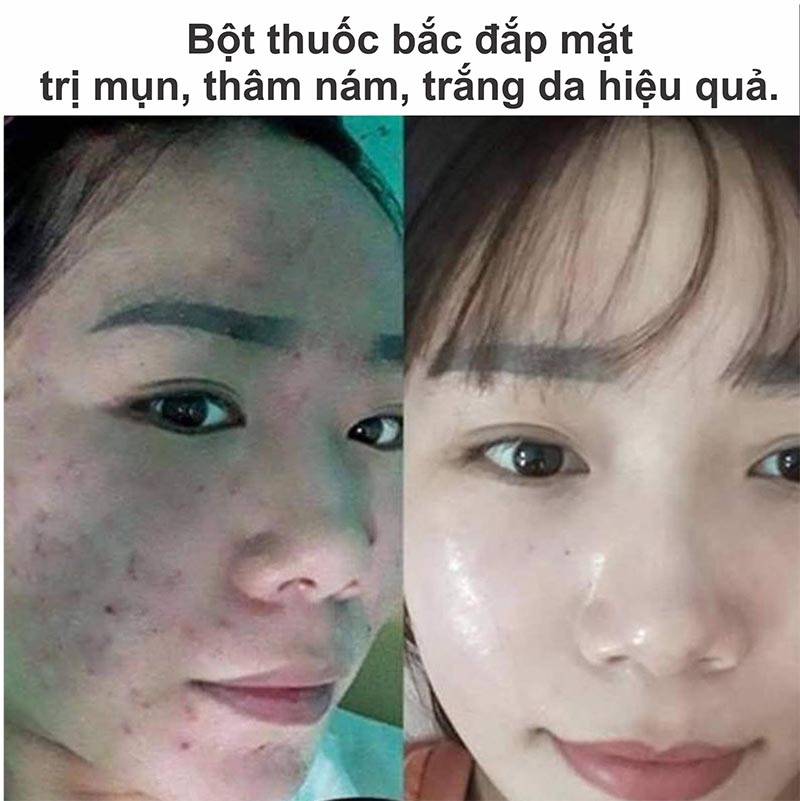 500G Bột thuôcc bắc (tặng 100G bột trà xanh) - Mặt nạ, tắm trắng toàn thân.
