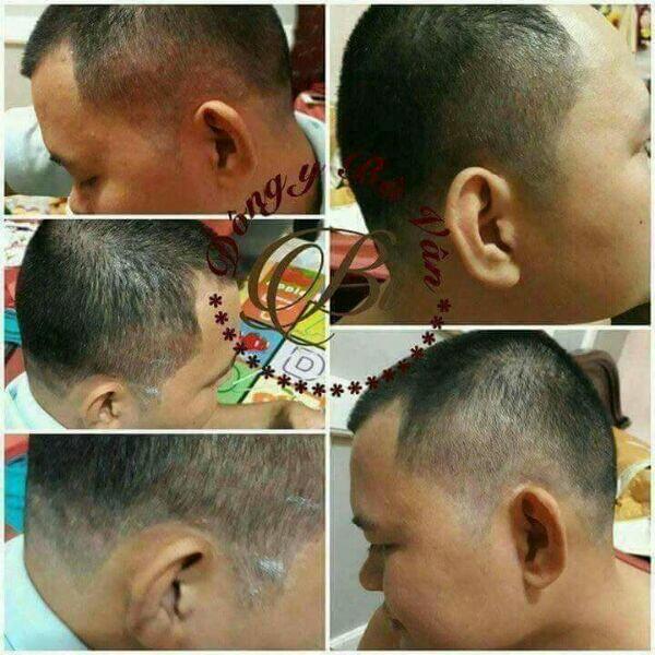 Đông Y Đa Năng Bà Vân Các Bệnh Ngoài Da