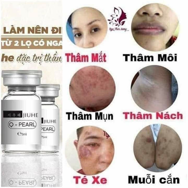serum jiuhe giảm thâm