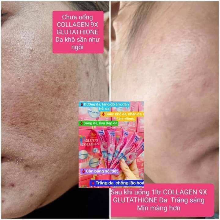 nước uống trắng da mờ nám 9x Collagen Glutathion