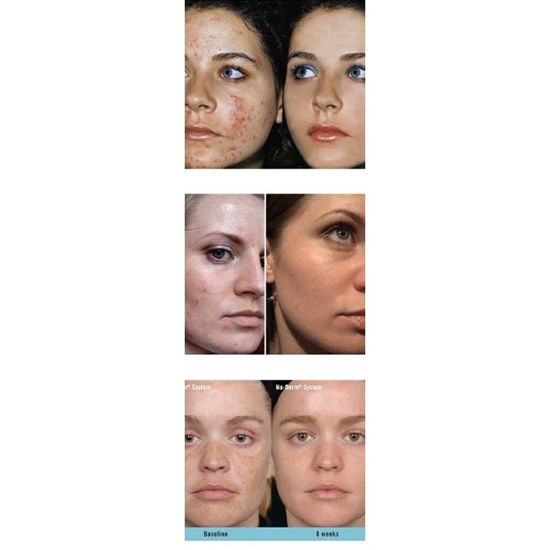 Serum Boltushka Propeller Immuno-
