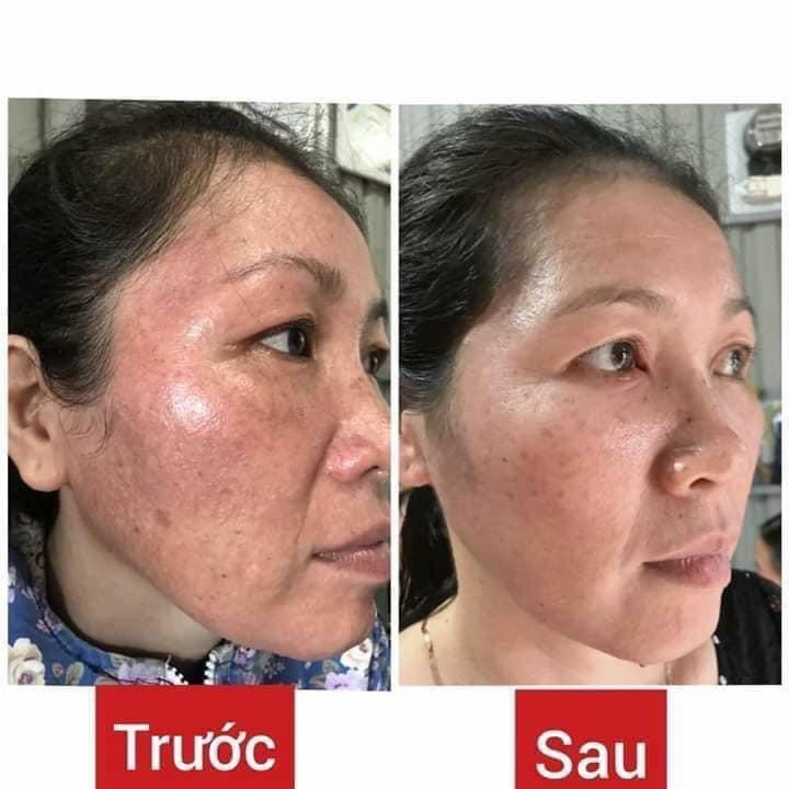 Kem face sữa cô gái núi