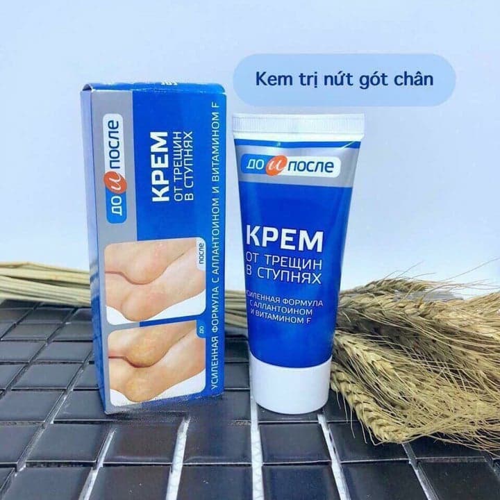 [HCM]Kem Nứt Gót Chân Kpem Nga 50ml