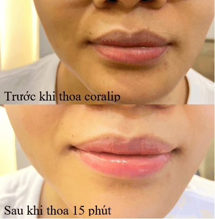[ CHÍNH HÃNG ] Son Dưỡng Môi Coralip