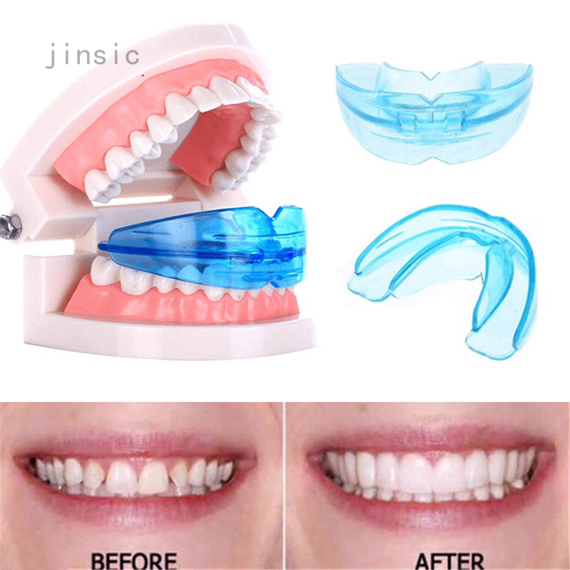 Niềng răng silicon - Dụng cụ niềng răng - Phương pháp tự niềng răng tại nhà hiệu quả