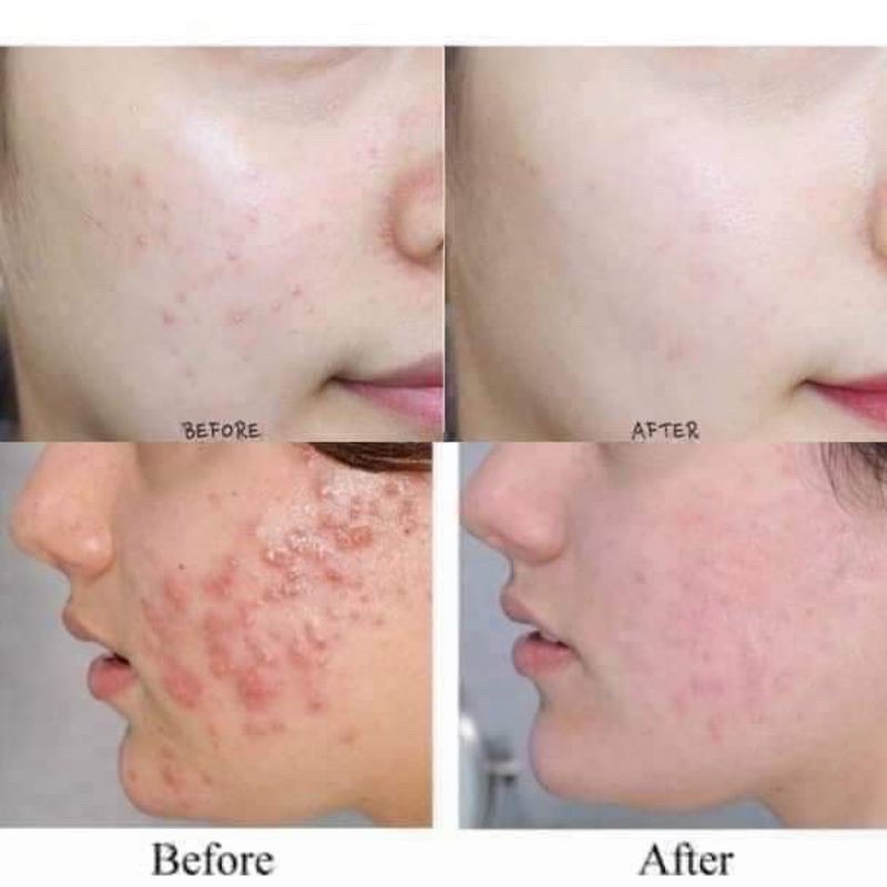 Sữa rửa mặt tinh chất nghệ Neutrogena Curcuma Clear