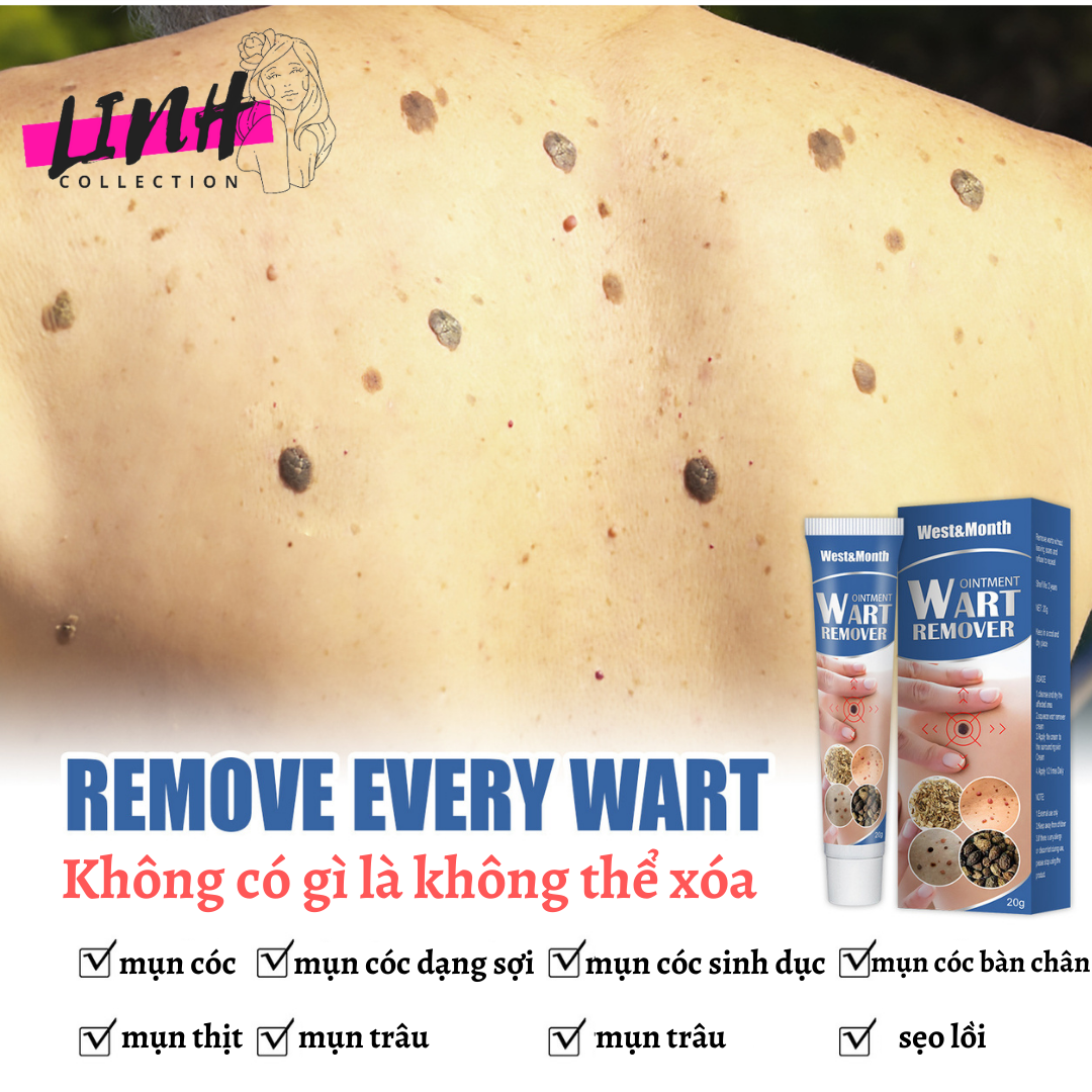 {ĐÁNH BẬT} MỤN CÓC, MỤN THỊT,MỤN CƠM,MỤN RUỒI TRÂU REMOVE EVERY WARTS CHÍNH HÃNG