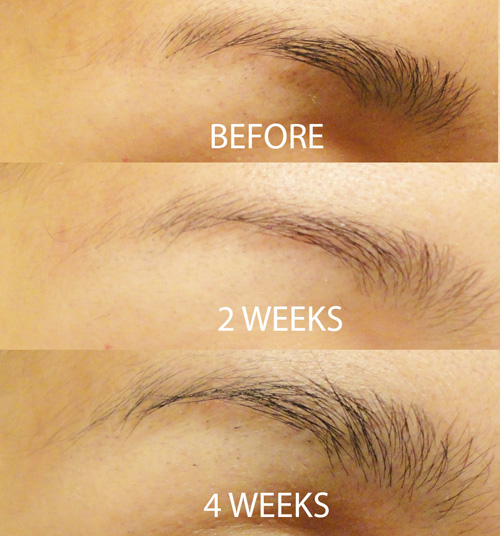 Serum mọc dài lông mày Revitabrow Advanced – 0.9ml