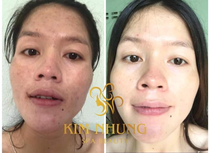 Kem đa năng Kim Nhung