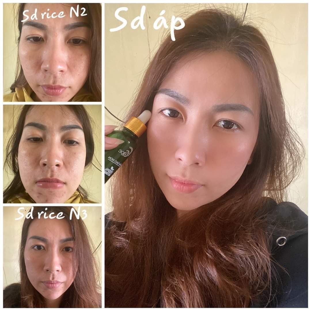 [KÈM QUÀ TẶNG] SERUM RICE MẦM GẠO NON XÓA MỤN MỜ THÂM NÁM SẠM DA