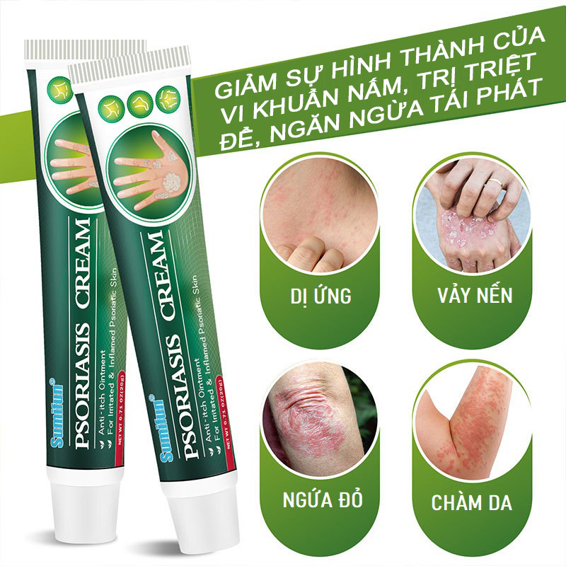 Kem Bôi Thảo Dược SUMIFUN Psoriasis Cream 20G Giúp Kháng Khuẩn Chống ...
