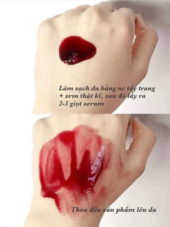 𝑅𝐸𝐷 𝑃𝐸𝐸𝐿 𝑇𝐼𝑁𝐺𝐿𝐸 𝑆𝐸𝑅𝑈𝑀 𝗣𝗘𝗘𝗟 𝗗𝗔 LỰU ĐỎ tái tạo căng bóng sạch mụn thâm nám tàn nhang không sưng đỏ dưỡng da