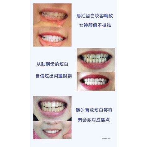 [ SẴN ] MIẾNG DÁN TRẮNG RĂNG 3D WHITE TEETH WHITENING STRIPS