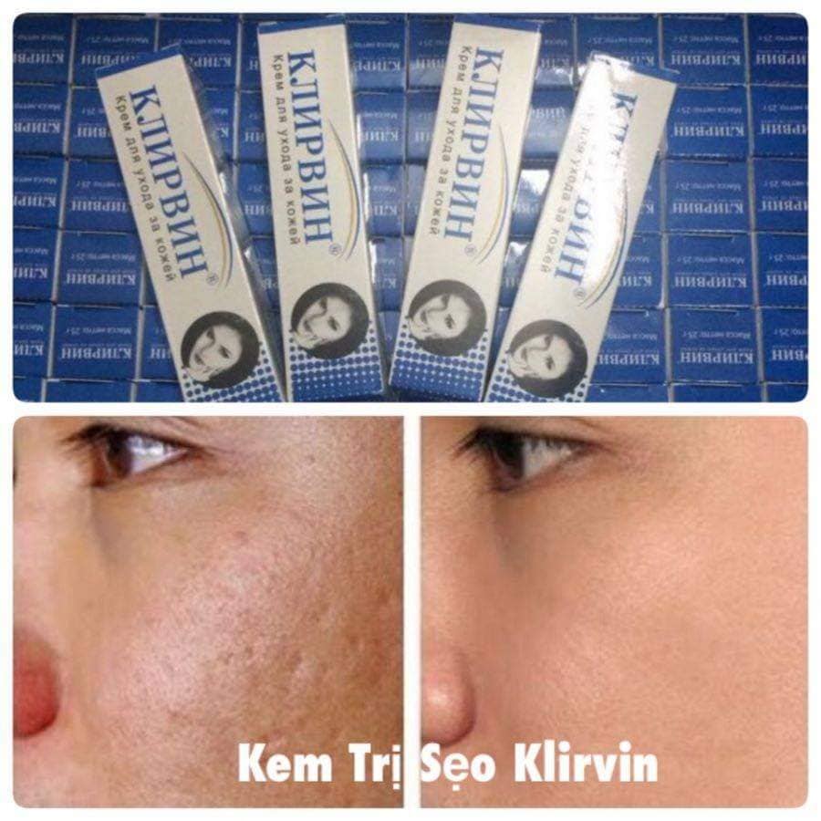 Kem mờ sẹo  KLIRVIN Nga 25g