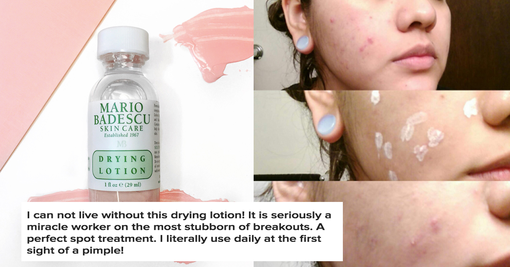 [29ml + Bill] Chấm Mụn Mario Badescu Drying Lotion
