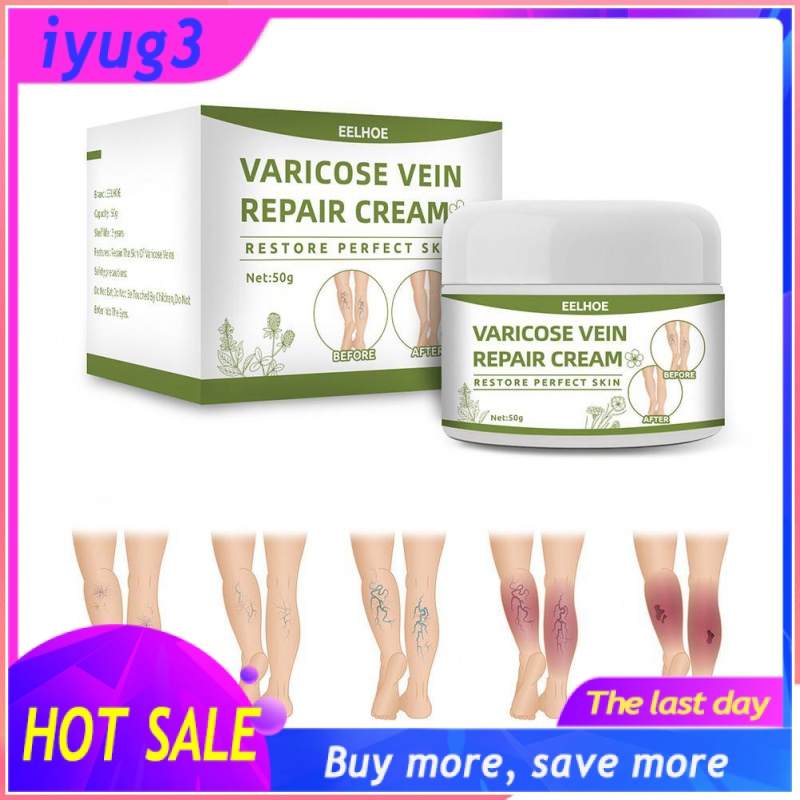 Varicose Veins Cream Natural Ointment for Varicose and Spider Veins Removal Spider Veins COD