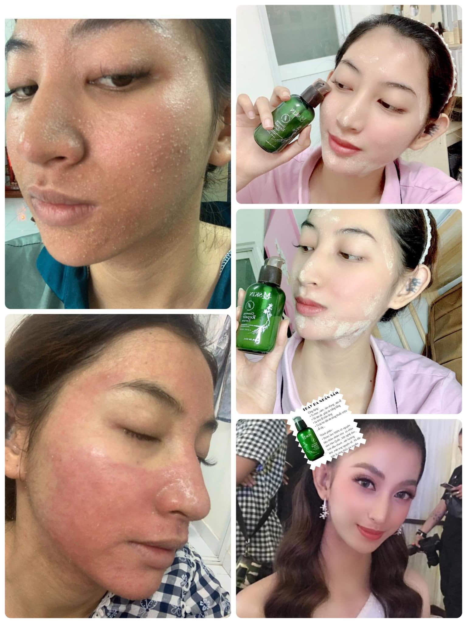 BB CREAM TÁI TẠO DA MQ Skin