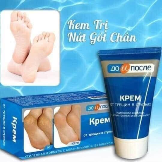 Kem nứt gót chân Kpem Apteka Nga