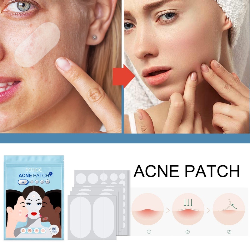 80Pcs Pimple Patch Makeup Invisible Hydrocolloid Comedo Patches