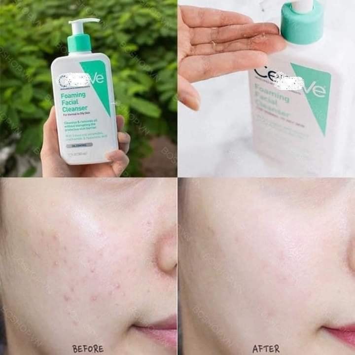 SỮA RỬA MẶT CERAVE 236ML