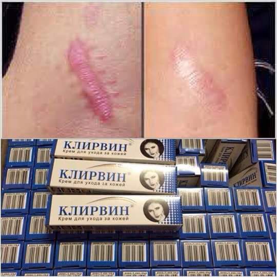 [HCM]Kem làm mờ hết sẹo Nga KLIRVIN