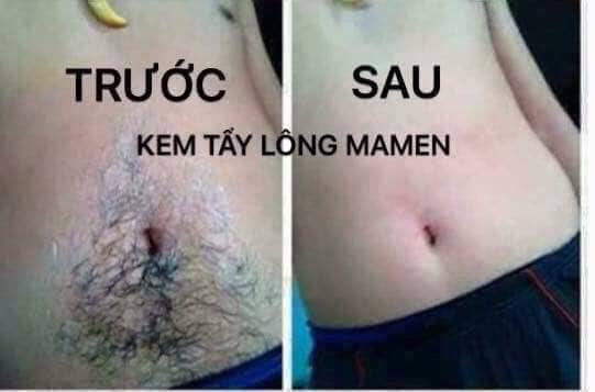 Hạt sang hạt sành dạ dày mua 2 tặng 1