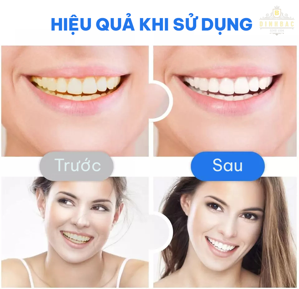 Miếng dán làm trắng răng tiện lợi Đình Bắc Store
