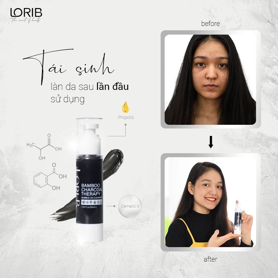 [HCM]Detox thải độc Lori B- 5ml