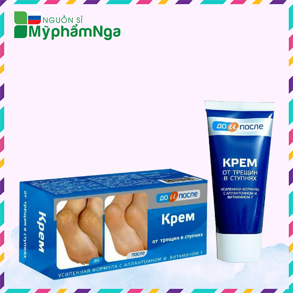 Kem giảm nứt gót chân Nga