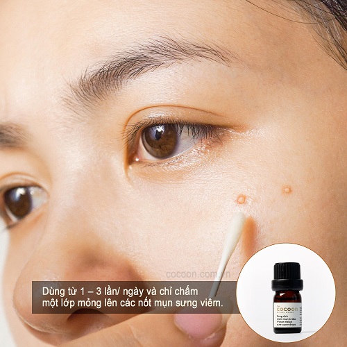 [COMBO 2 LỌ] Dung dịch chấm mụn bí đao cocoon vietnam 5ml