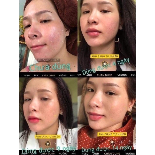 Cao mụn sâm đỏ 36 vị - meea organic Hủ Lớn 15Gr