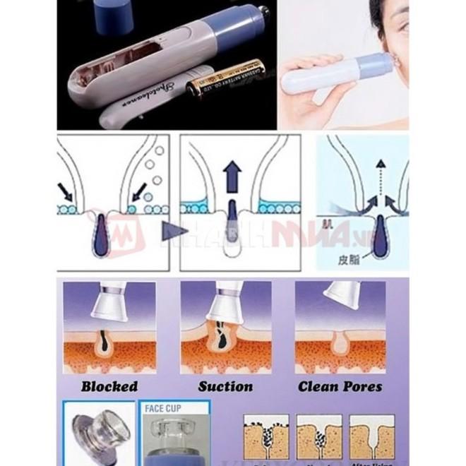 Máy hút mụn trứng cá