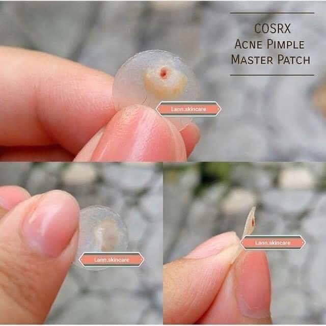MIẾNG DÁN MỤN CORSX MASTER PATCH ĐEN