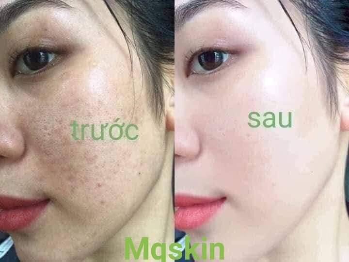 Thay Da Nhân Sâm Mq Skin[Chính Hãng]