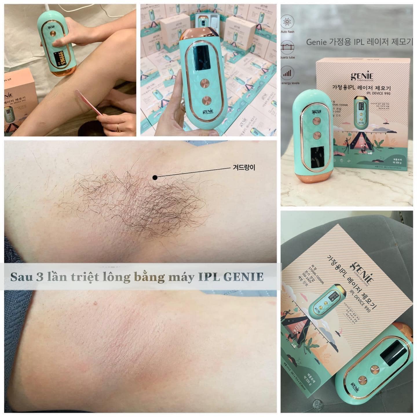 [HCM]Máy triệt lông tai nhà GENIE - Hàn Quốc