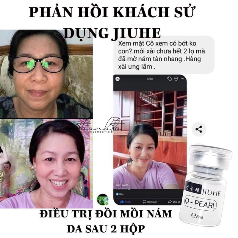 Sỉ jiuhe chính hãng mờ thâm nám sạm