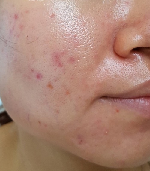 Sữa rửa mặt Compliment No Problem
