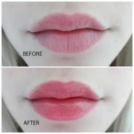 Dưỡng Môi Vaseline 7G Dạng Hũ Chính Hãng