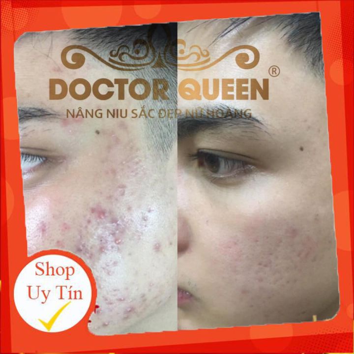 Serum Detox Mụn Doctor Queen 🔥𝐍𝐄𝐖🔥 (Ngừa Tất Cả Các Loại Mụn,Thâm,Đào Thải Phục Hồi Tái Tạo Da,Da Yếu, Giãn Mao Mạch)