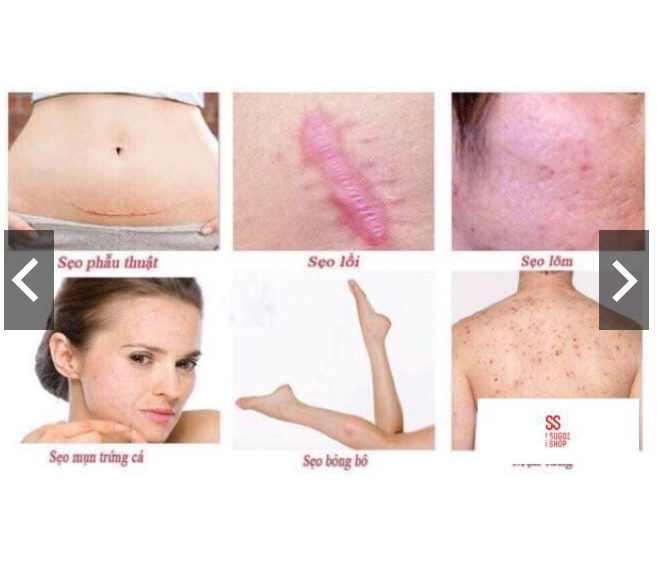 Kem sẹo Gentacin Nhật Bản 10gr