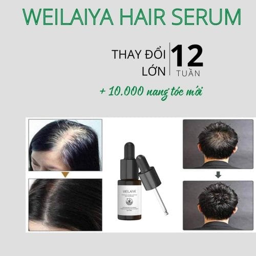 Serum Huyết Thanh Giúp Mọc Tóc Weilaiya [ CHÍNH - HÃNG ]