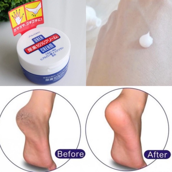 Kem nứt gót shiseido urea cream