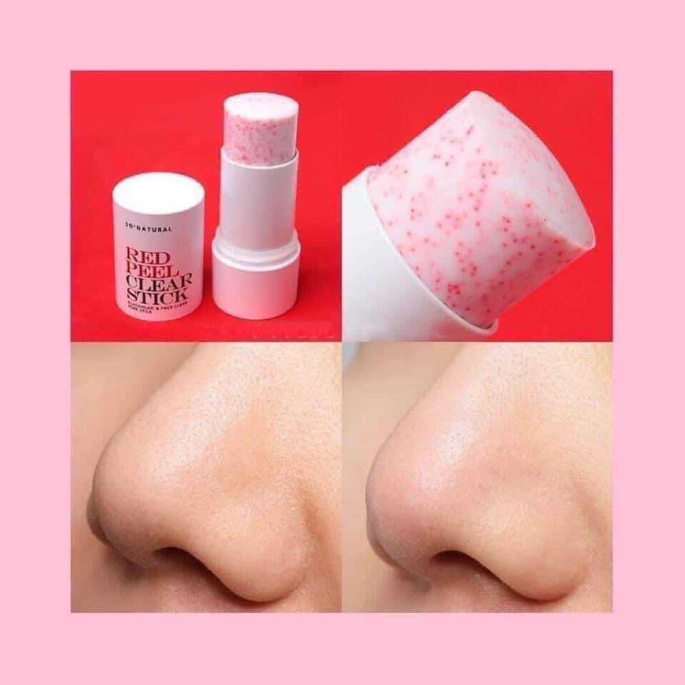 [HCM][HÀN QUỐC] THANH LĂN MỤN ĐẦU ĐEN RED PEEL CLEAR STICK PORE BLACKHEAD & FACE