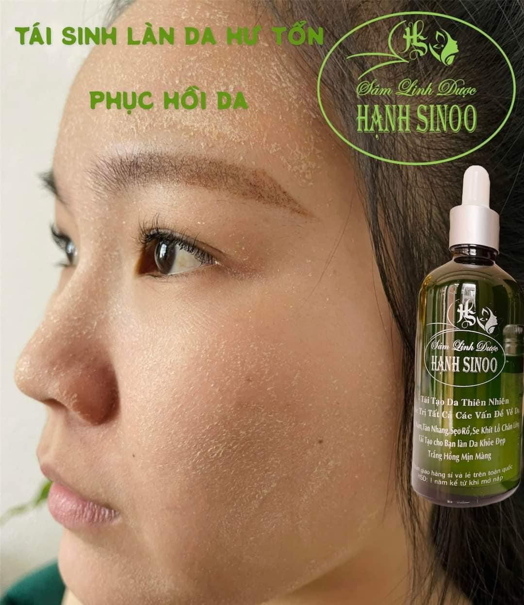 COMBOL SÂM LINH DƯỢC HẠNH SINOO(BỘT SÂM)
