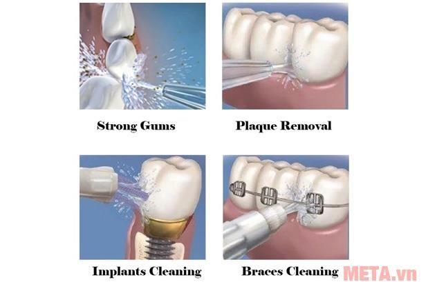 Máy tăm nước du lịch Waterpules V400 Plus